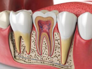 root canal treatment summit view biological dentistry dentist in park city ut